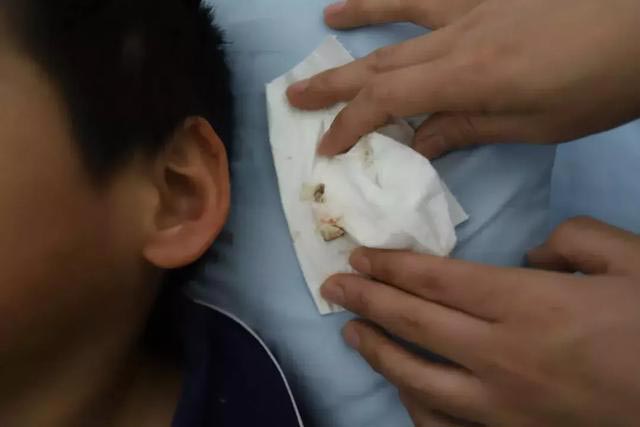 แม่เลี้ยงทำร้ายลูก