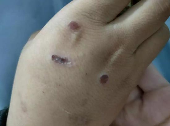 แม่เลี้ยงทำร้ายลูก