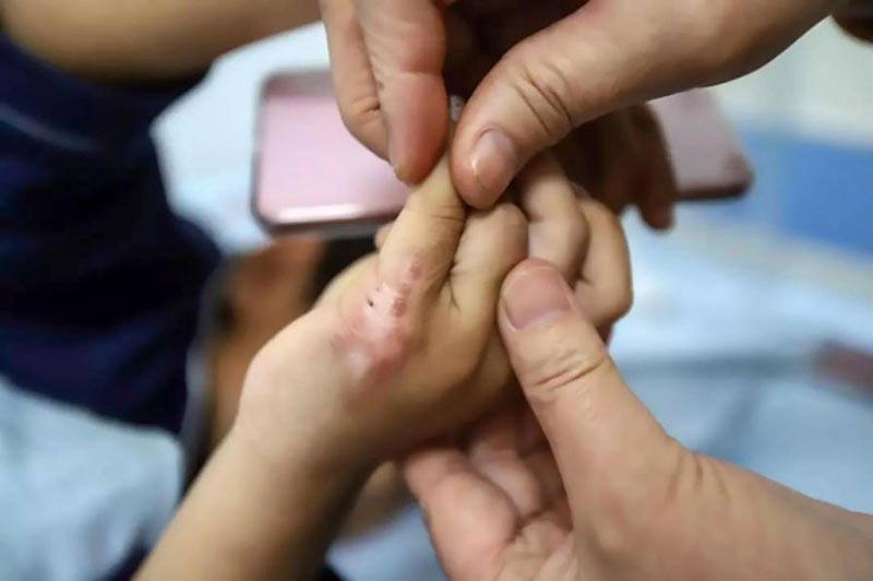 แม่เลี้ยงทำร้ายลูก