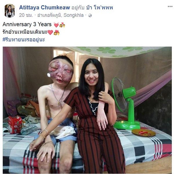 มะเร็งที่ตา