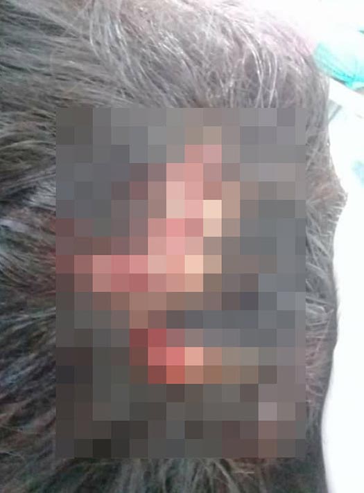 ทำร้ายผู้หญิง