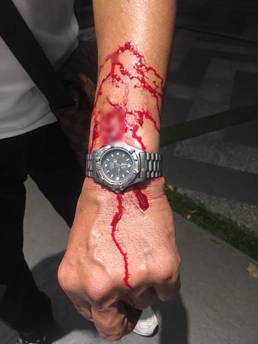 ปาขวดใส่