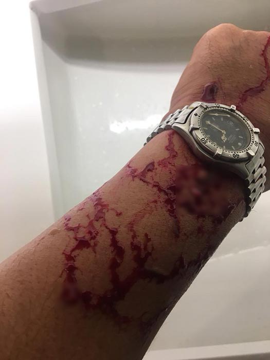 ปาขวดใส่