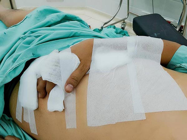 ปลากระเบนเฉี่ยว