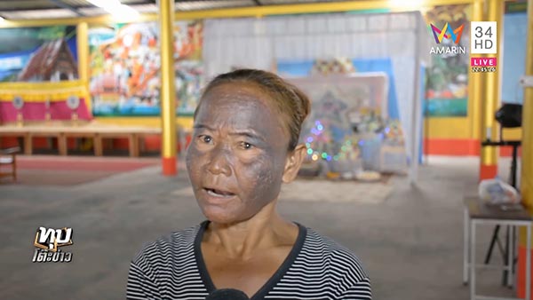 เตะบอลอัดขา