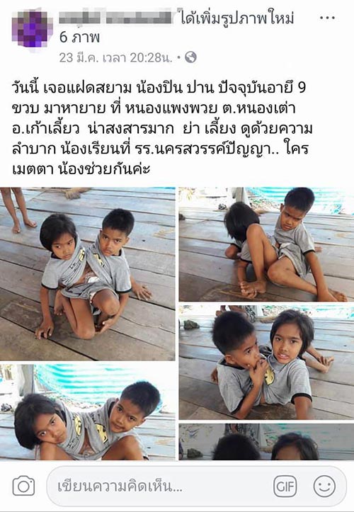 แฝดสยาม