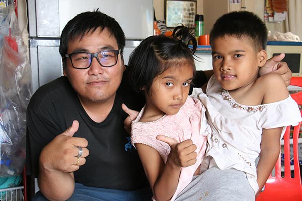 แฝดสยาม