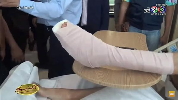 ฉลามกัด