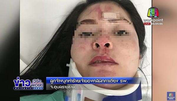 ทำร้ายนายจ้าง