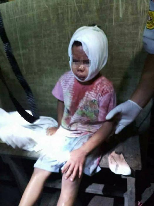 พ่อทำร้ายลูก