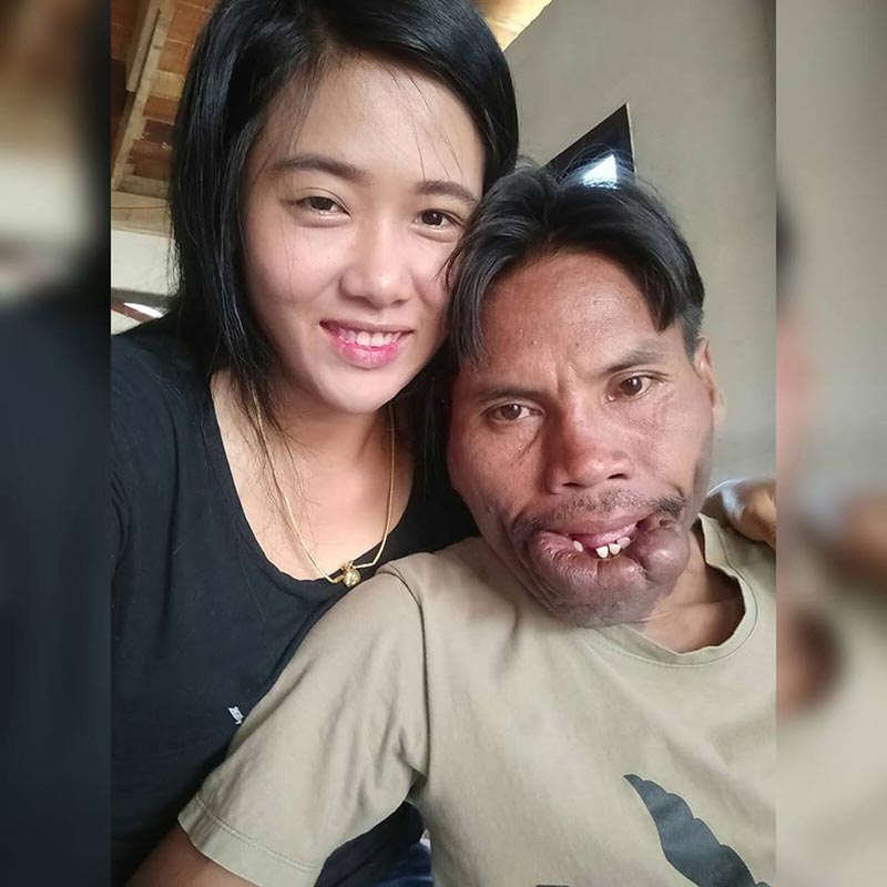 น้องบี มีมี่