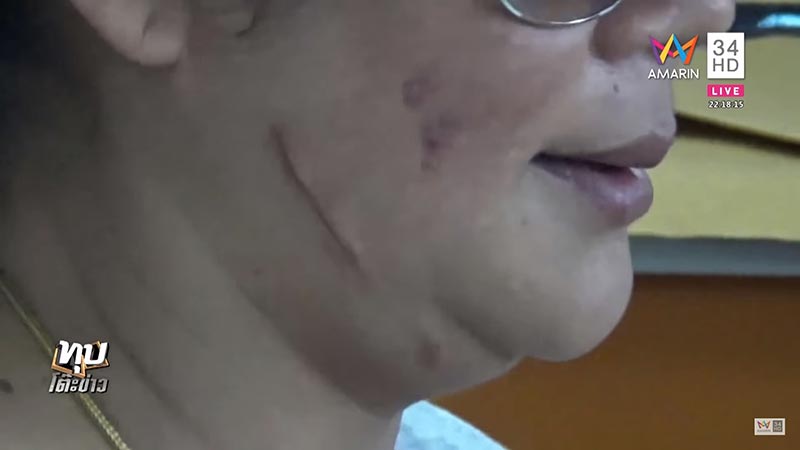 หมอเถื่อน