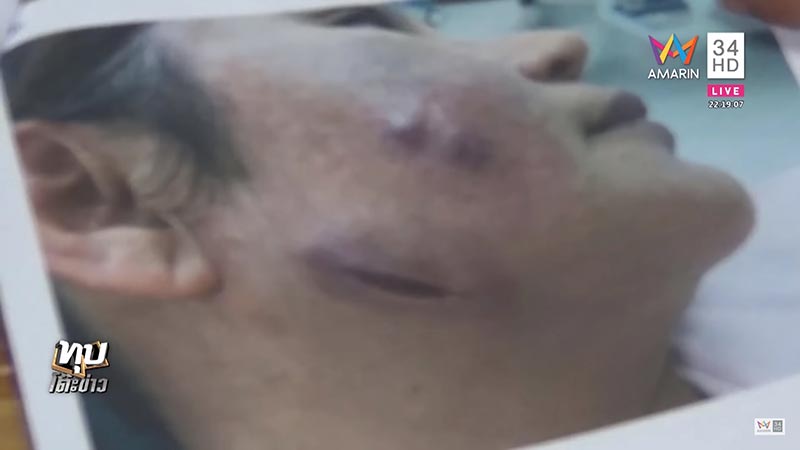 หมอเถื่อน