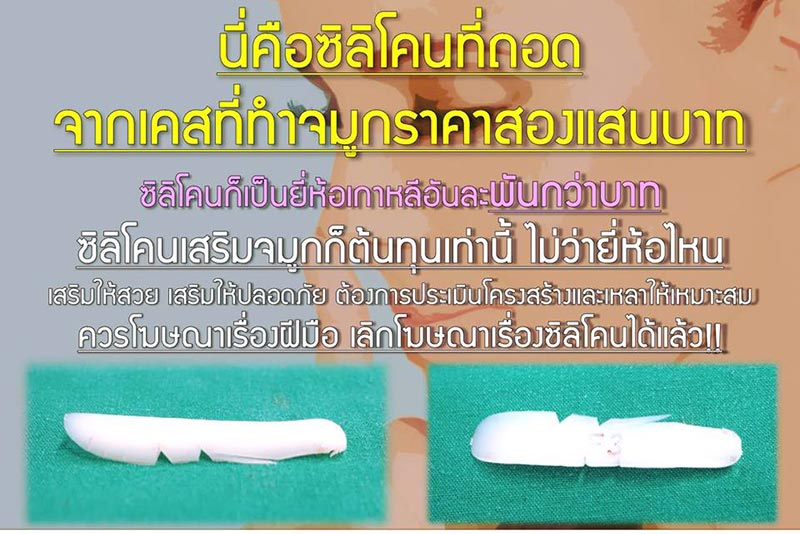 ศัลยกรรมจมูก