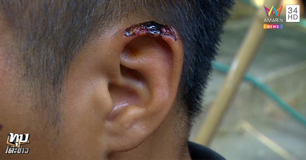 ผูกคอกลางวัด