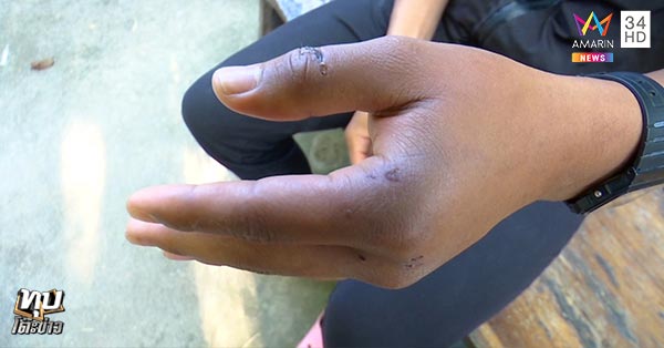 ผูกคอกลางวัด