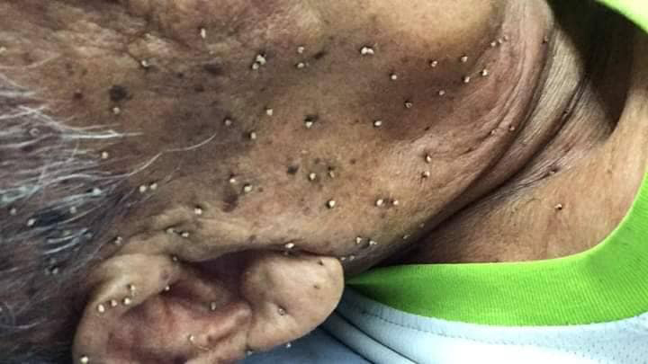 ผึ้งหลวงรุมต่อย