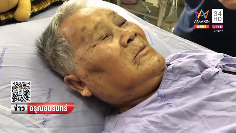 ผึ้งหลวงรุมต่อย