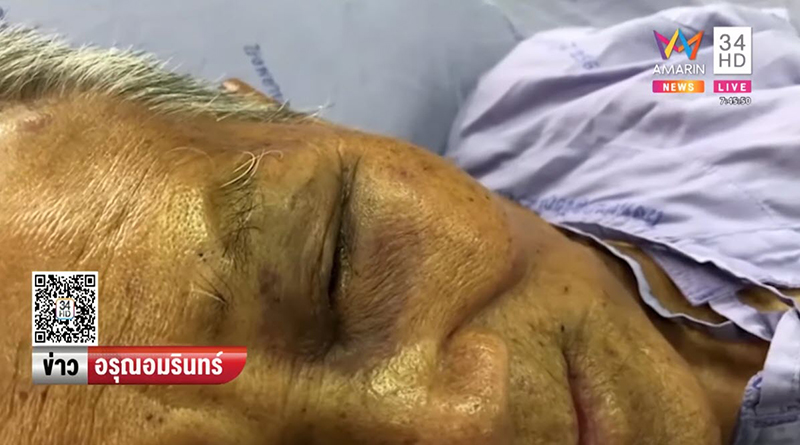 ผึ้งหลวงรุมต่อย