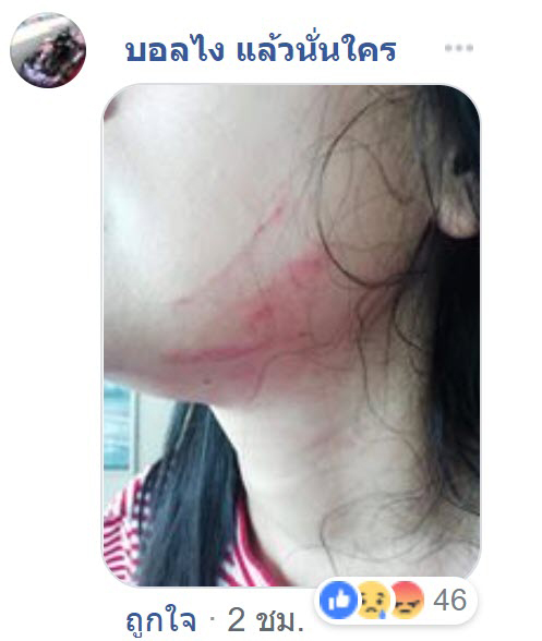 ทำร้ายเด็ก
