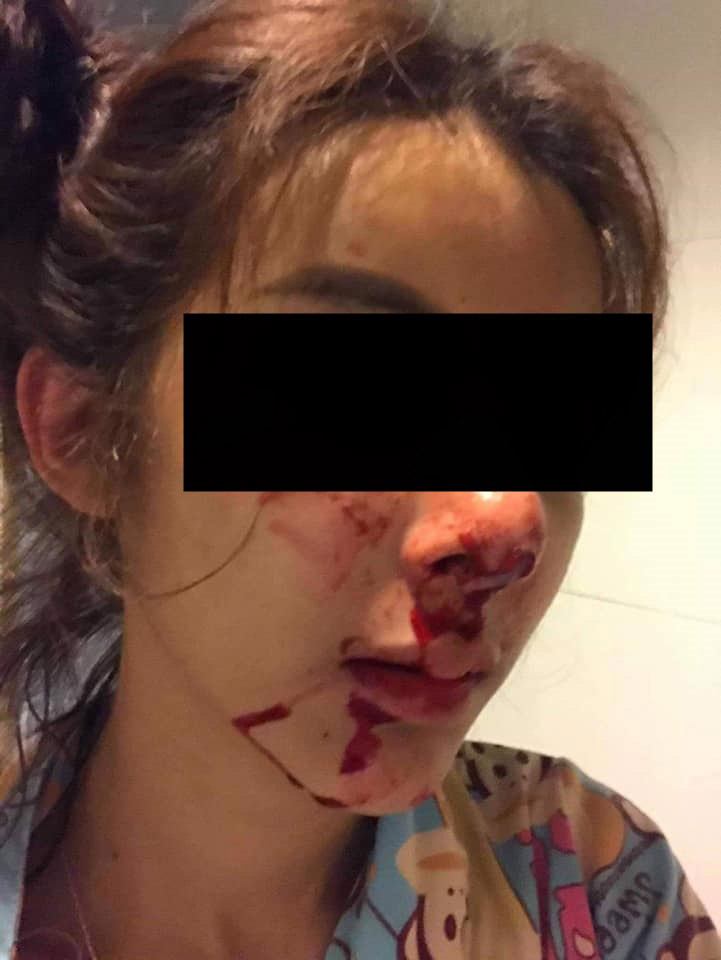 ทำร้ายแฟน