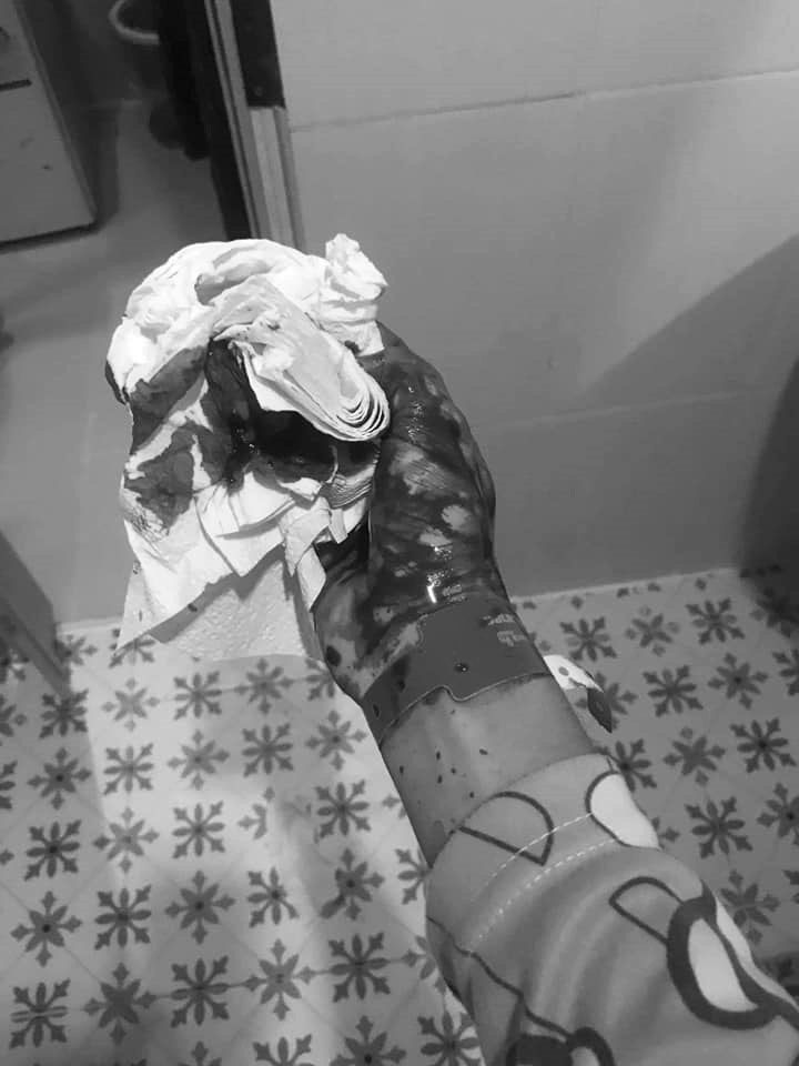 ทำร้ายแฟน