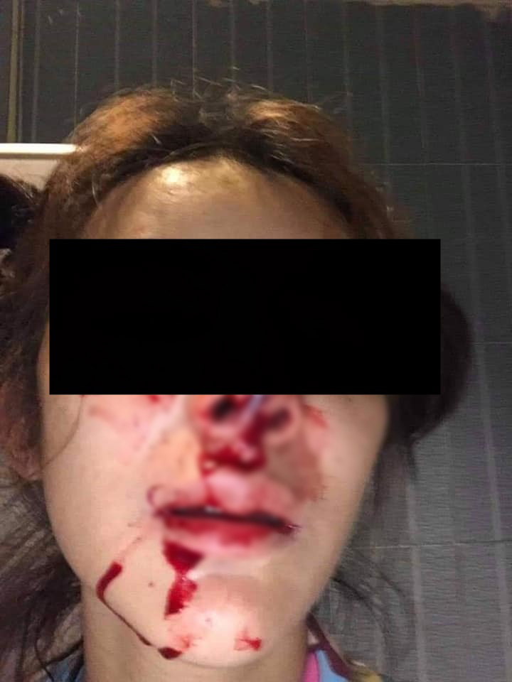 ทำร้ายแฟน