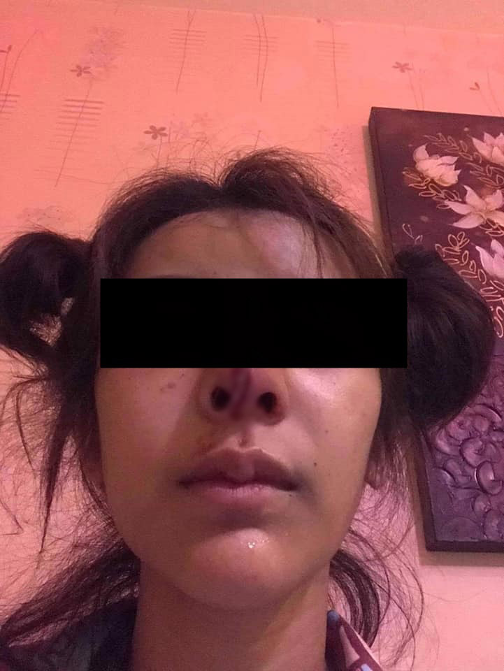 ทำร้ายแฟน