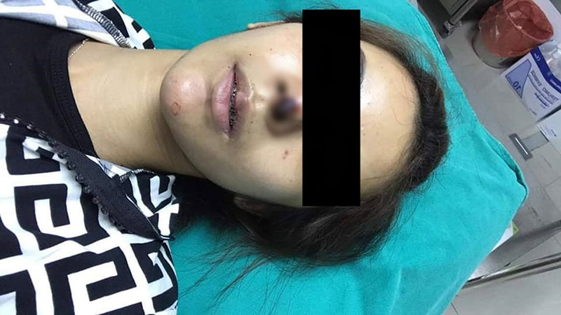 ทำร้ายแฟน