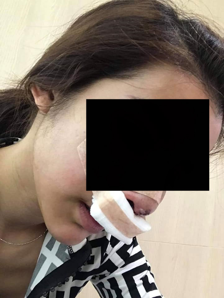 ทำร้ายแฟน