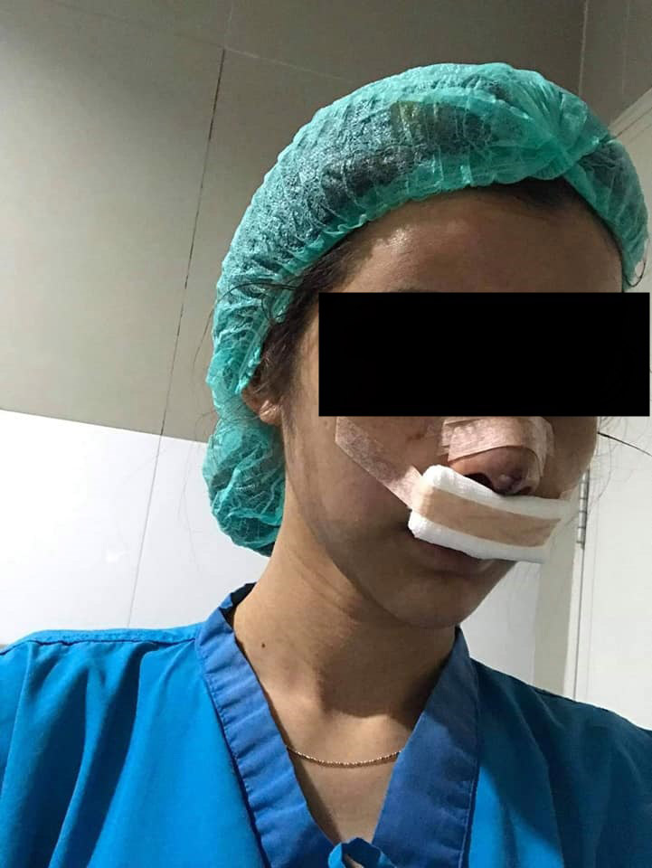 ทำร้ายแฟน