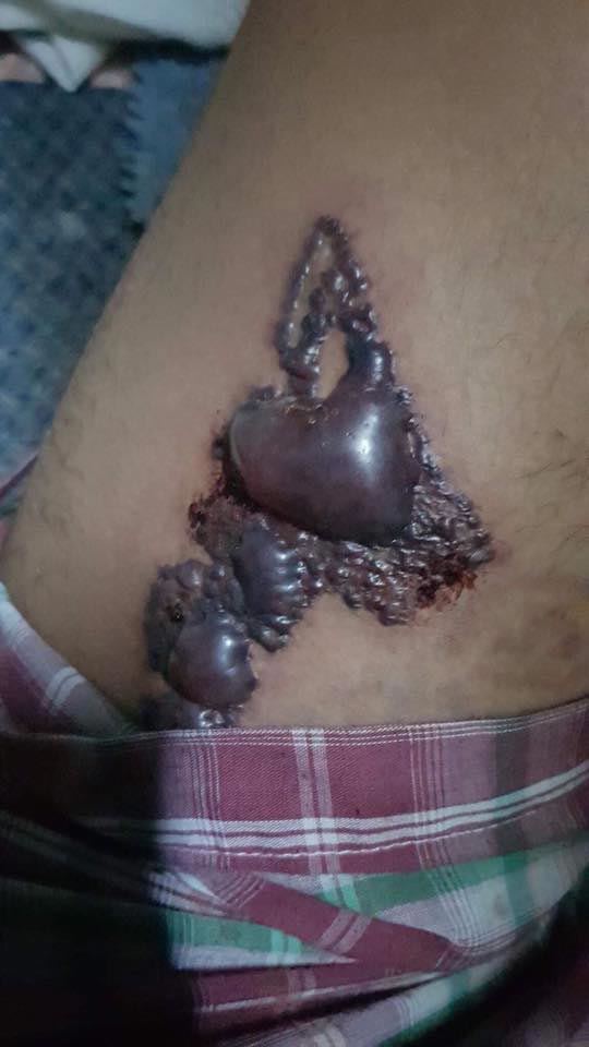 สักร่างกาย