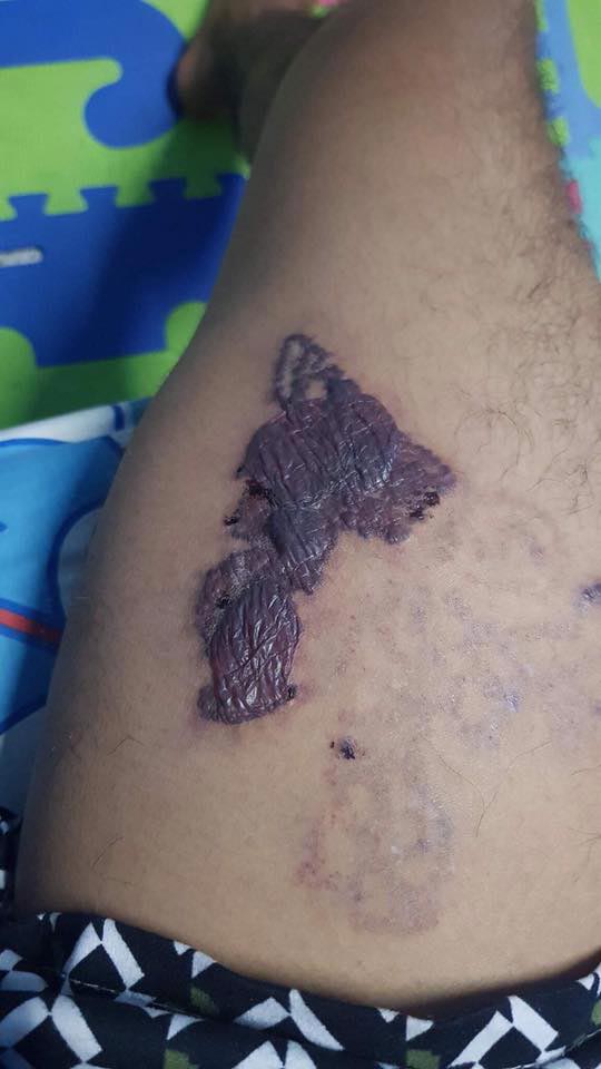 สักร่างกาย