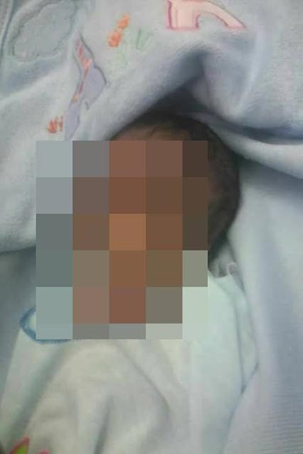 หมอทำคลอดทารกหัวขาด