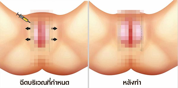 จิ๋ม 3 มิติ