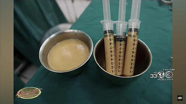 จิ๋ม 3 มิติ