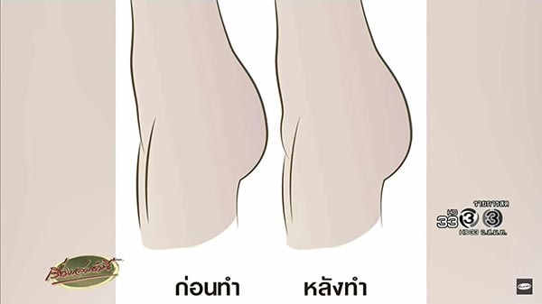 จิ๋ม 3 มิติ