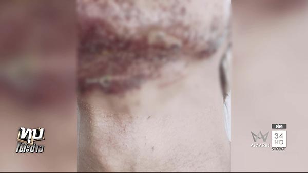 โวยคลินิกความงาม