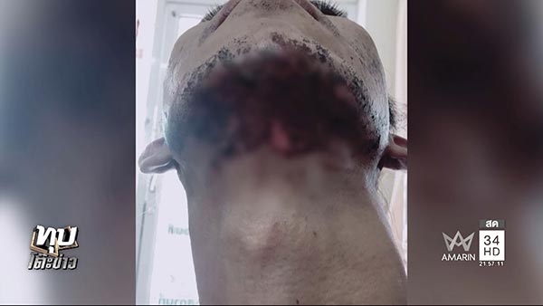 โวยคลินิกความงาม