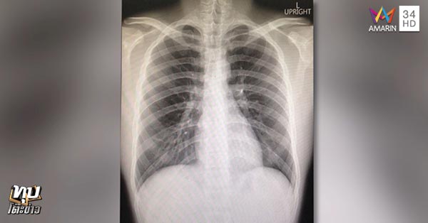 น้องเมย