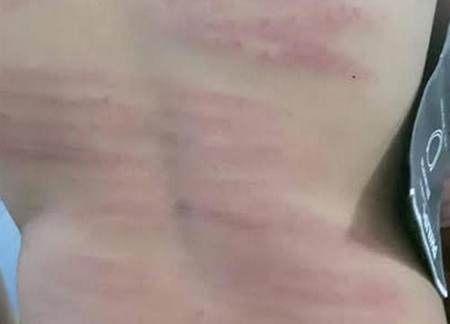 ครูใช้ไม้พลองตีเด็ก