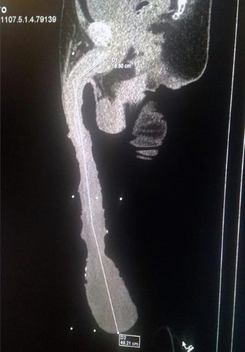 จู๋ยาวที่สุดในโลก