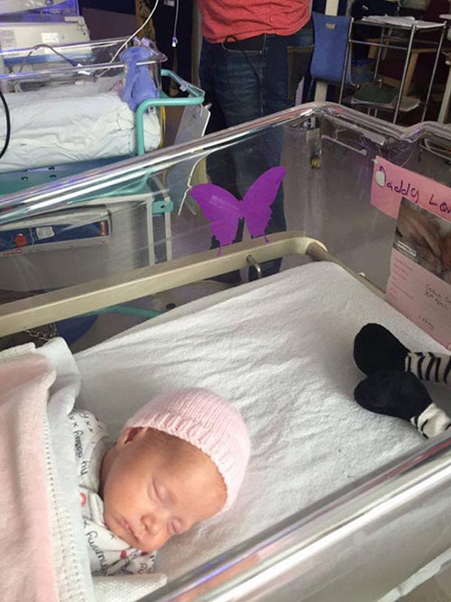 ภาวะเด็กกบ