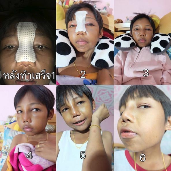 สุชาติ แคปเจอร์