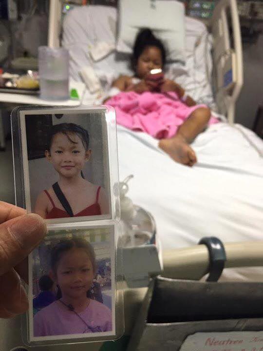 เด็กถูกรถเมล์ทับขาขาด