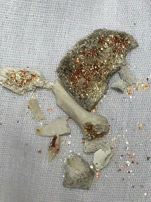 พระธาตุซิลิก้า