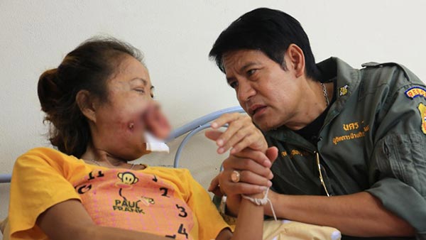 มะเร็งช่องปาก