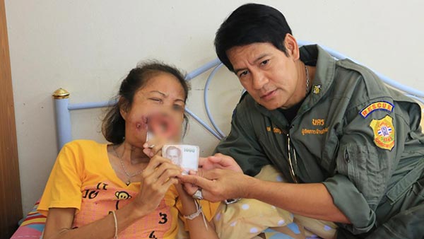 มะเร็งช่องปาก