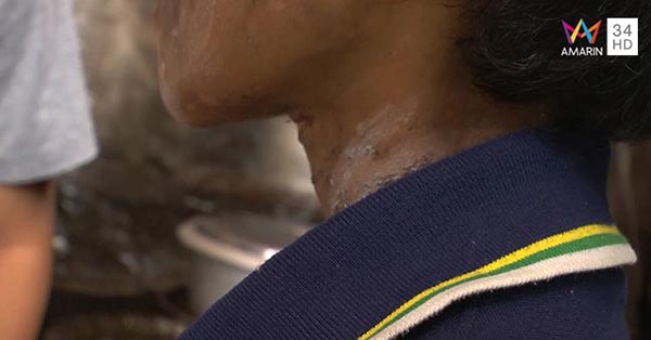 เด็ก 11 ขวบ