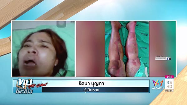 สาดน้ำร้อน